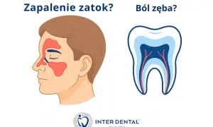 Zapalenie zatok czy ból zęba? Dowiedz się, jak zmniejszyć ciśnienie w zębie i pozbyć się bólu.