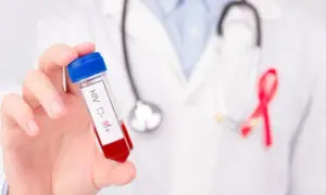 Leczenie HIV w Polsce: Czy jest bezpłatne? Pełna refundacja