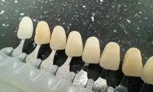 Paleta próbek pokazuje różne kolory zębów, od bieli po odcienie żółci i beżu.