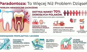 Paradontoza to niewidoczne zagrożenie, które dotyka 70% dorosłych Polaków, prowadząc do utraty zębów i atakując cały organizm.