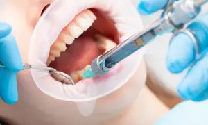 Znieczulenie u dentysty w ciąży: Czy jest bezpieczne? Poradnik