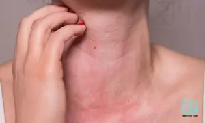 Alergia na nikiel w ustach: objawy, przyczyny i skuteczne leczenie