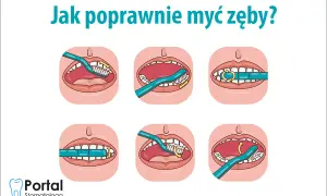 Jak myć zęby szczoteczką soniczną? Pełny przewodnik krok po kroku