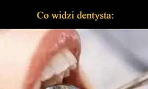 Co widzi dentysta? Pełny obraz Twojego zdrowia z ust