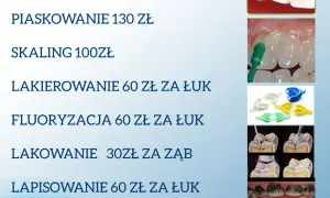 Ile kosztuje wyrwanie zęba w Polsce? Ceny i porównanie NFZ