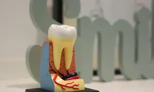 Model zęba z widocznymi korzeniami, naczyniami krwionośnymi i nerwami. Pokazuje przekrój, jak przy hemisekcji zęba.