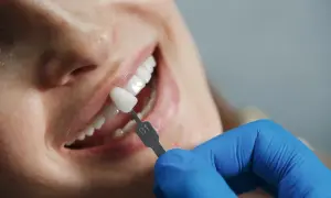 Co dentysta wkłada do zęba po usunięciu? Wyjaśniamy