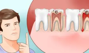 Ból zęba: Jak dentysta diagnozuje i leczy? Przewodnik