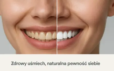 Porównanie uśmiechu: zęby przed i po zabiegu poprawiającym estetykę zębów. Białe, zdrowe zęby dodają pewności siebie.