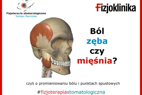 Model czaszki z zaznaczonymi mięśniami żuchwy. Pytanie: Ból zęba czy mięśnia? #fizjoterapiastomatologiczna