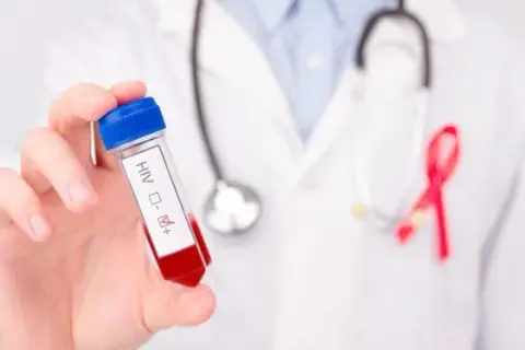 Leczenie HIV w Polsce: Czy jest bezpłatne? Pełna refundacja