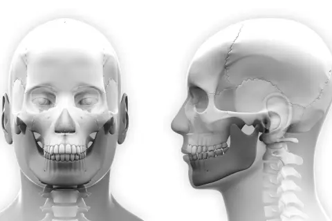 Anatomia czaszki z przodu i z boku, ukazująca staw skroniowo-żuchwowy, kluczowy przy zwichnięciu szczęki.
