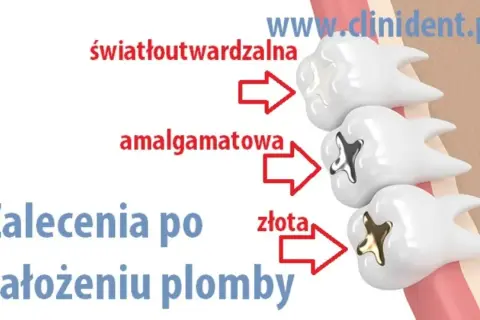 Kiedy jeść po dentyście? Sprawdź, co wolno, a czego unikać
