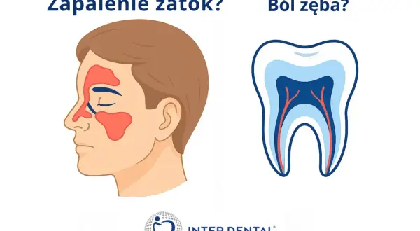 Zapalenie zatok czy ból zęba? Dowiedz się, jak zmniejszyć ciśnienie w zębie i pozbyć się bólu.