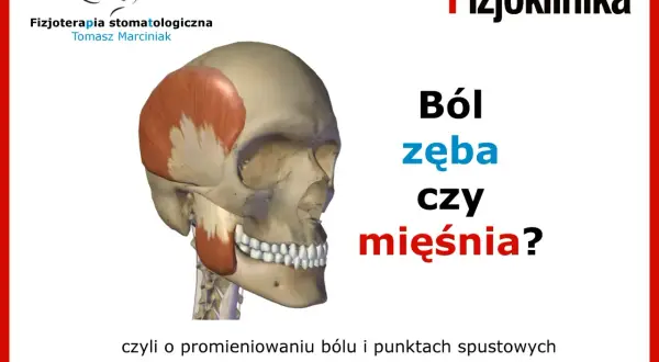 Model czaszki z zaznaczonymi mięśniami żuchwy. Pytanie: Ból zęba czy mięśnia? #fizjoterapiastomatologiczna