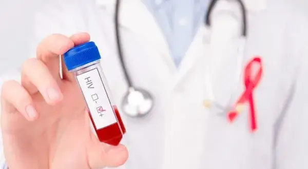 Leczenie HIV w Polsce: Czy jest bezpłatne? Pełna refundacja