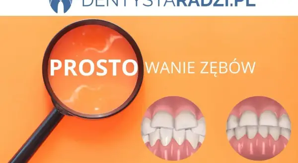 Proste licówki na krzywe zęby. Zobacz metamorfozę uśmiechu przed i po zabiegu.