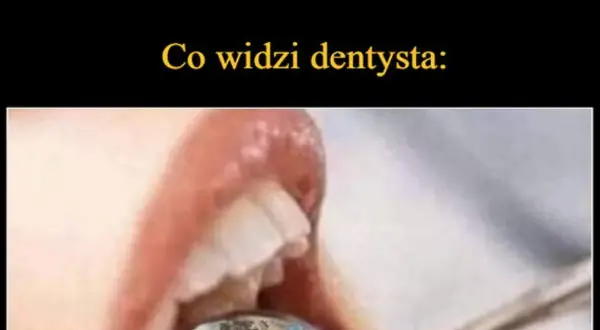 Co widzi dentysta? Pełny obraz Twojego zdrowia z ust