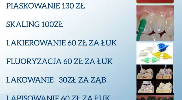 Ile kosztuje wyrwanie zęba w Polsce? Ceny i porównanie NFZ
