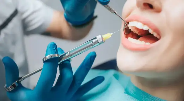 Dentysta podaje znieczulenie powierzchniowe. Pacjentka ma otwarte usta, a stomatolog używa strzykawki i narzędzia.