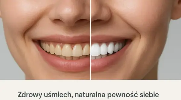 Porównanie uśmiechu: zęby przed i po zabiegu poprawiającym estetykę zębów. Białe, zdrowe zęby dodają pewności siebie.