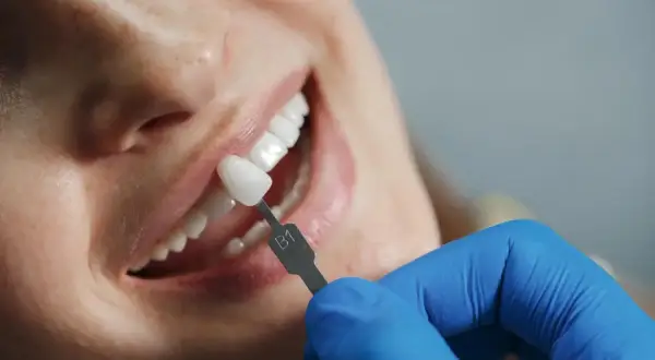 Co dentysta wkłada do zęba po usunięciu? Wyjaśniamy