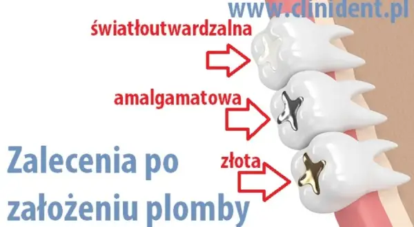 Kiedy jeść po dentyście? Sprawdź, co wolno, a czego unikać