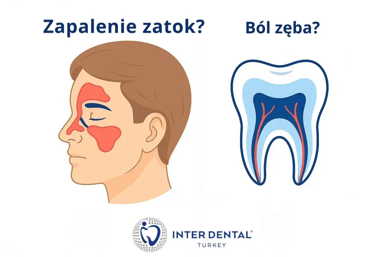 Zapalenie zatok czy ból zęba? Dowiedz się, jak zmniejszyć ciśnienie w zębie i pozbyć się bólu.
