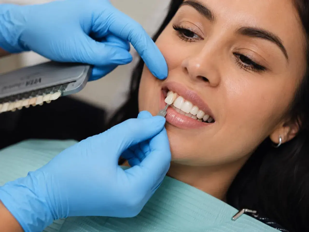 Dobór idealnego odcienia pasty do licówek kompozytowych. Dentysta porównuje kolor zębów pacjentki z wzornikiem.