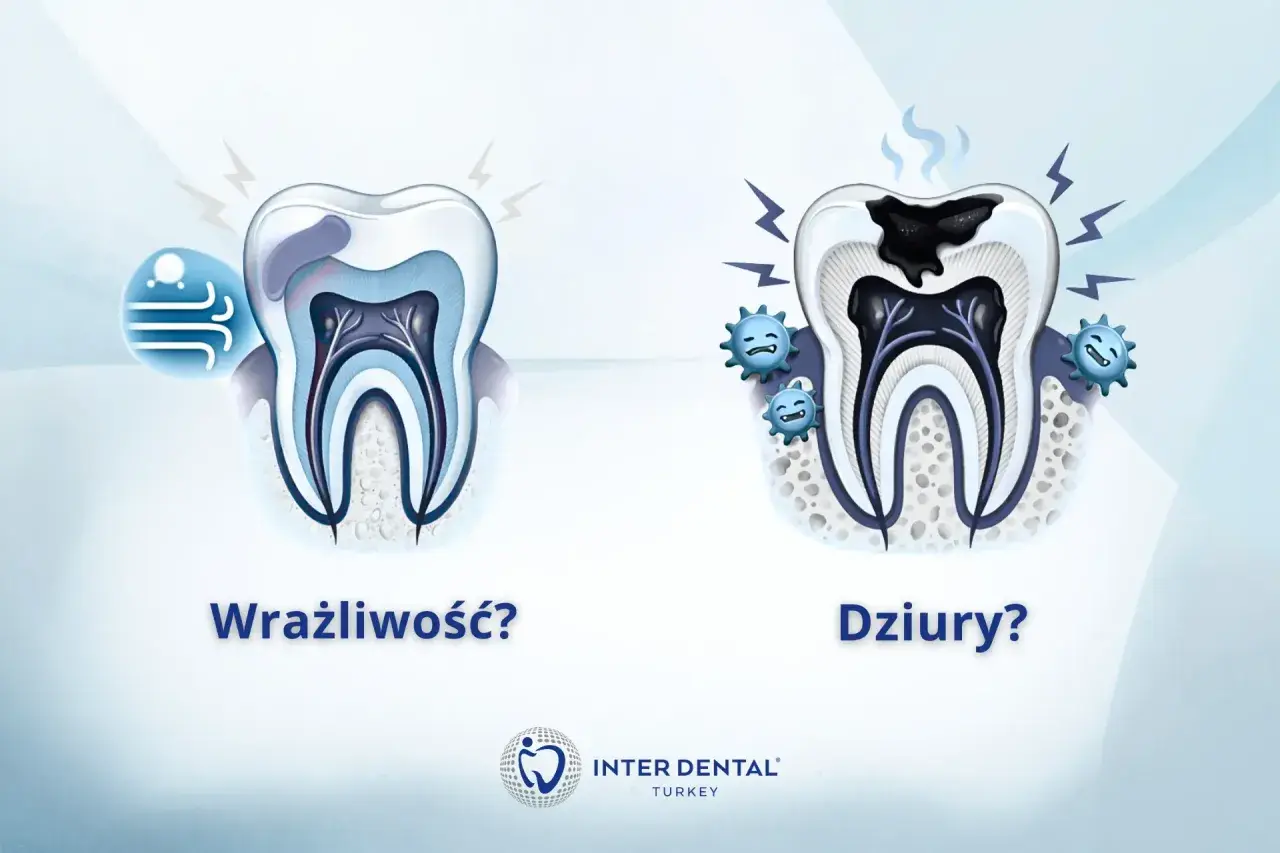 Wrażliwość zęba przy nagryzaniu? Zobacz, jak próchnica niszczy ząb, powodując ból.