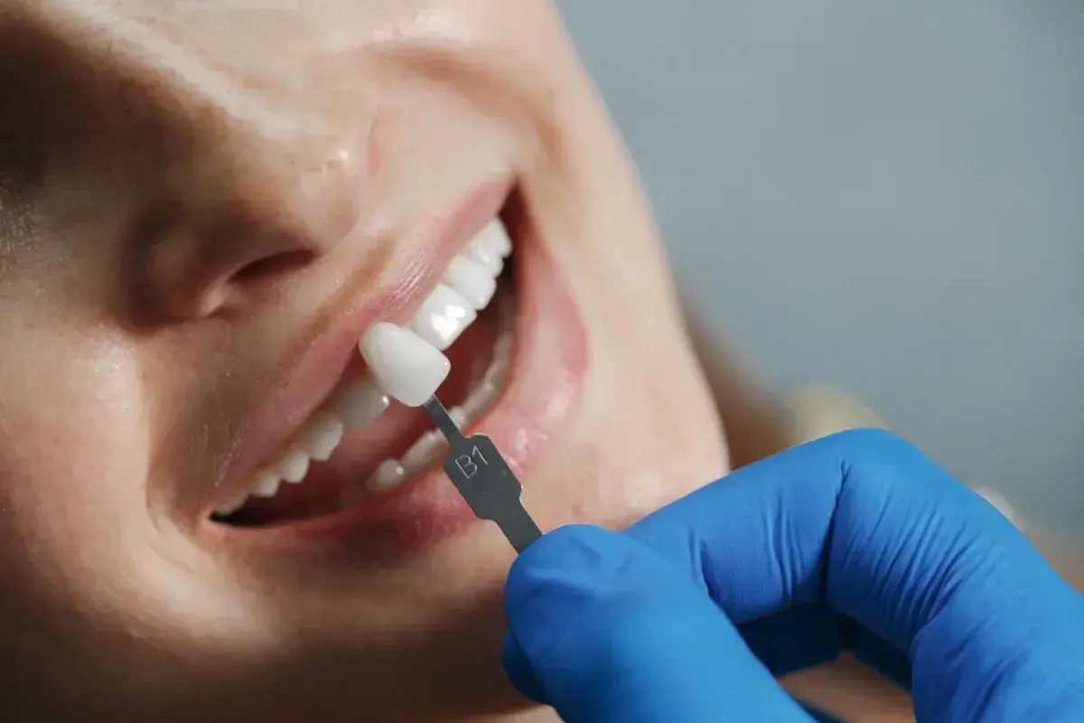 Co dentysta wkłada do zęba po usunięciu? Wyjaśniamy