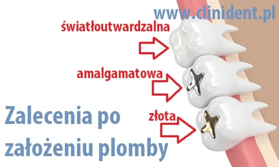 Kiedy jeść po dentyście? Sprawdź, co wolno, a czego unikać