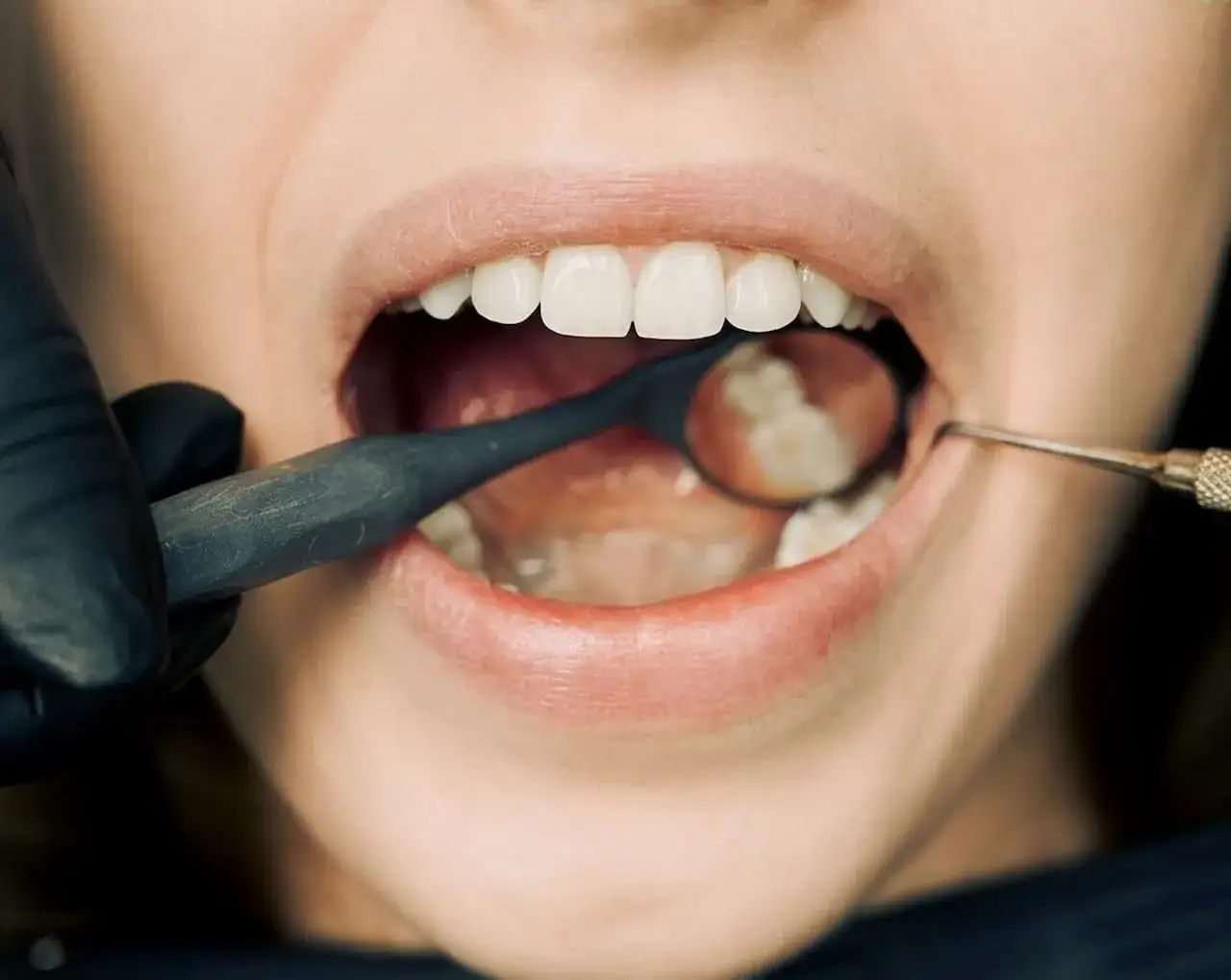 dentysta leczący ropień zęba
