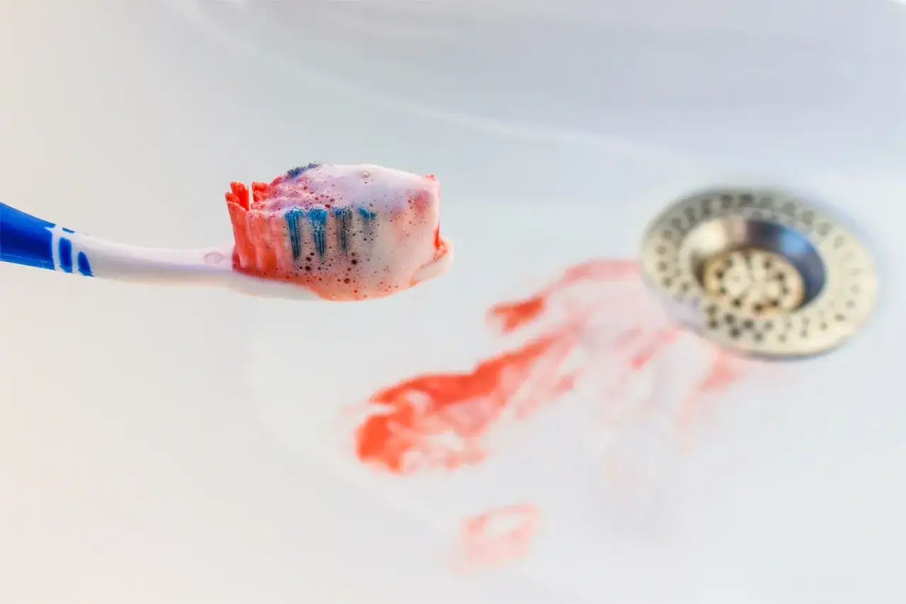Kiedy iść do dentysty z krwawiącymi dziąsłami