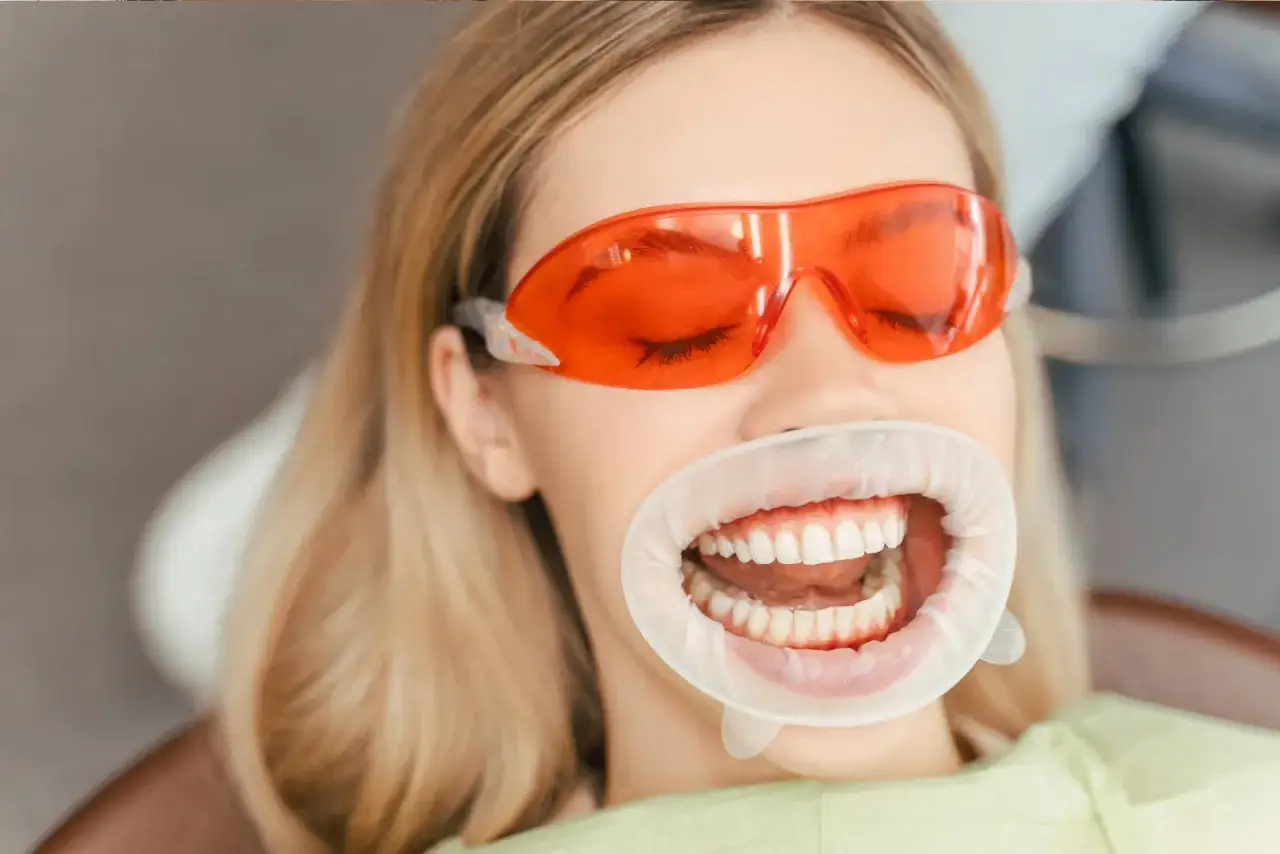 Kobieta w okularach ochronnych przechodzi zabieg bezpieczne wybielanie zębów. Uśmiech z rozwierakiem dentystycznym.