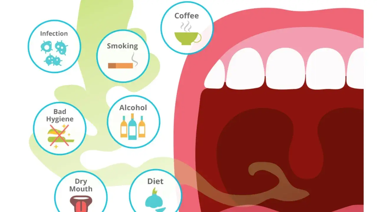 Ilustracja pokazuje czynniki powodujące nieprzyjemny zapach z przestrzeni międzyzębowych: infekcje, palenie, alkohol, złą higienę, suchość w ustach i dietę.