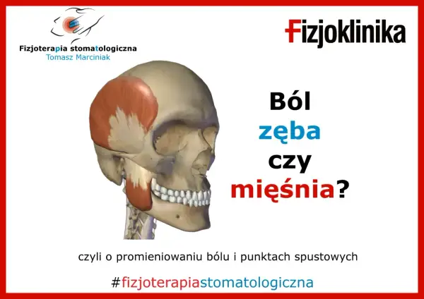 Model czaszki z zaznaczonymi mięśniami żuchwy. Pytanie: Ból zęba czy mięśnia? #fizjoterapiastomatologiczna