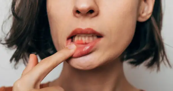 Jak usunąć jedzenie z dziąsła? Domowe sposoby i kiedy iść do dentysty